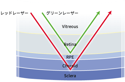 4種類のレーザー光源