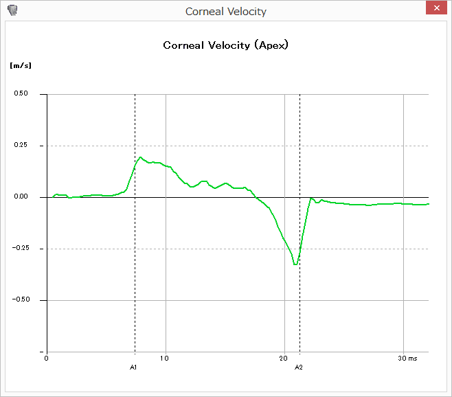 角膜頂点の変形速度