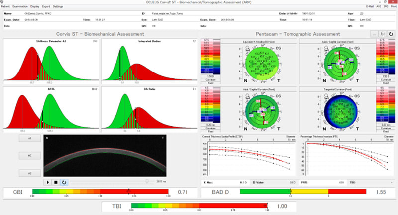 Vinciguerra Screening Report