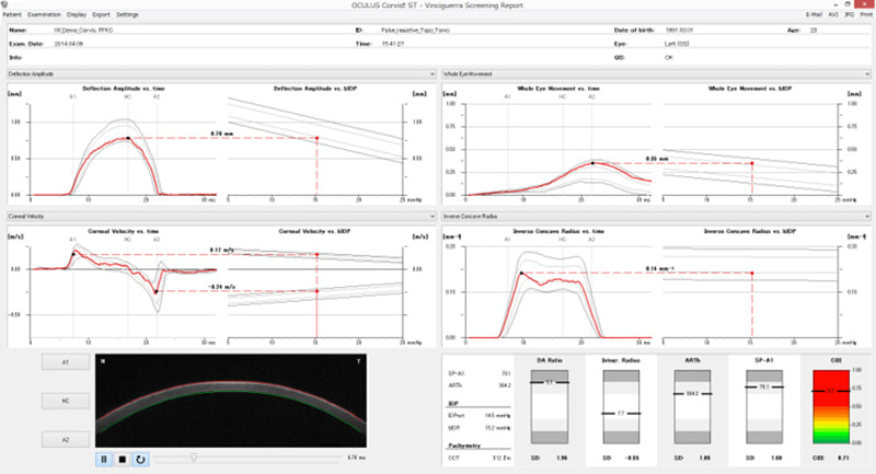 Vinciguerra Screening Report