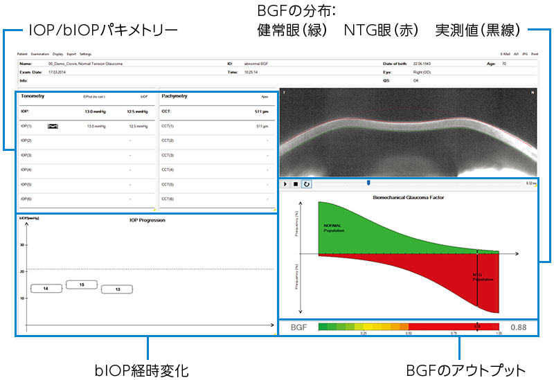 Vinciguerra Screening Report