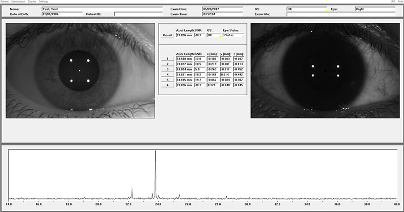 AXL-Scan