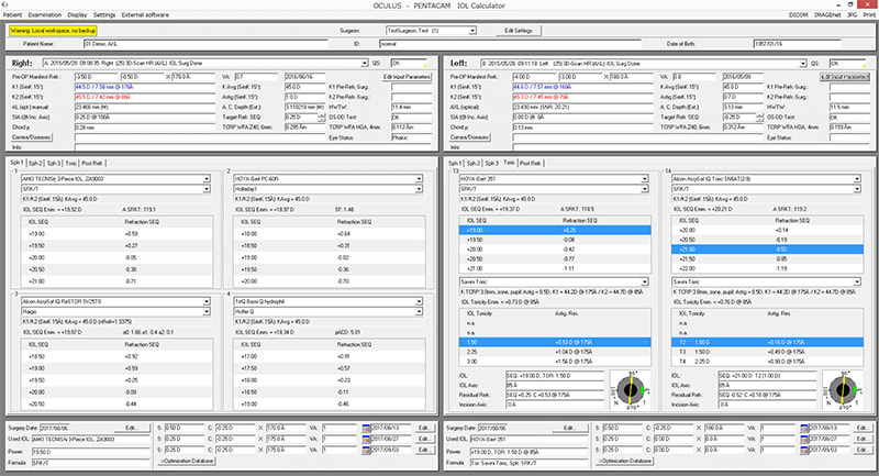 IOL Calculator