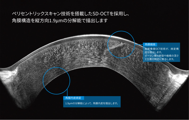 ペリセントリックスキャン技術を搭載したSD-OCTを採用し、角膜構造を縦方向1.9μmの分解能で描出します
