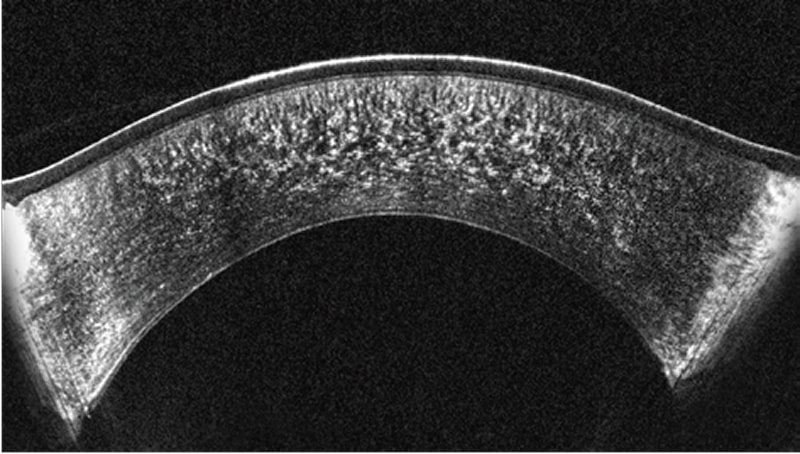 アベレージングモード