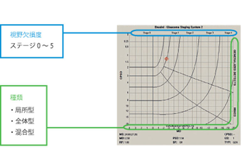 Glaucoma Staging System(GSS2)