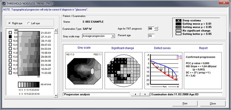 Threshold Noiseless Trend(TNT)