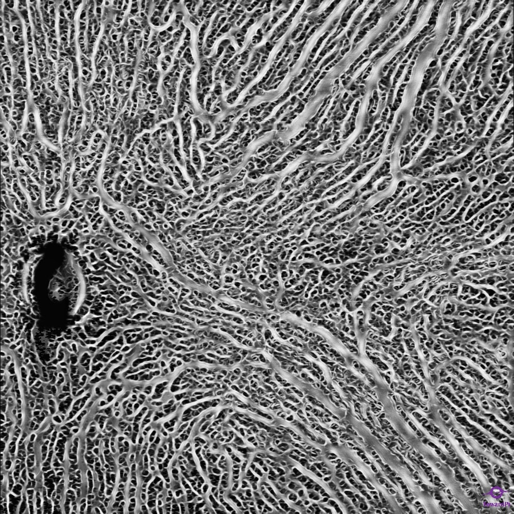 Choroid